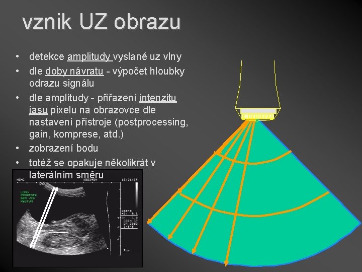 vznik UZ obrazu • detekce amplitudy vyslané uz vlny • dle doby návratu -