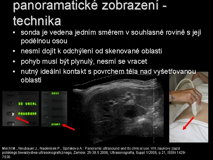 panoramatické zobrazení - technika • sonda je vedena jedním směrem v souhlasné rovině s