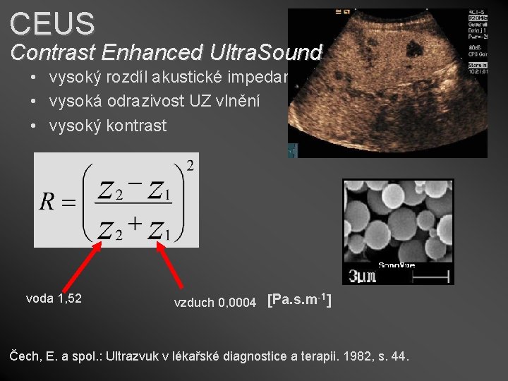 CEUS Contrast Enhanced Ultra. Sound • vysoký rozdíl akustické impedance • vysoká odrazivost UZ