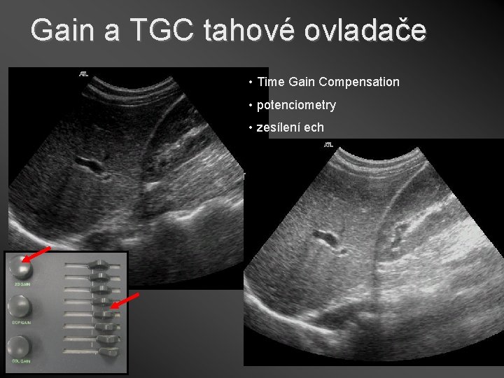 Gain a TGC tahové ovladače • Time Gain Compensation • potenciometry • zesílení ech