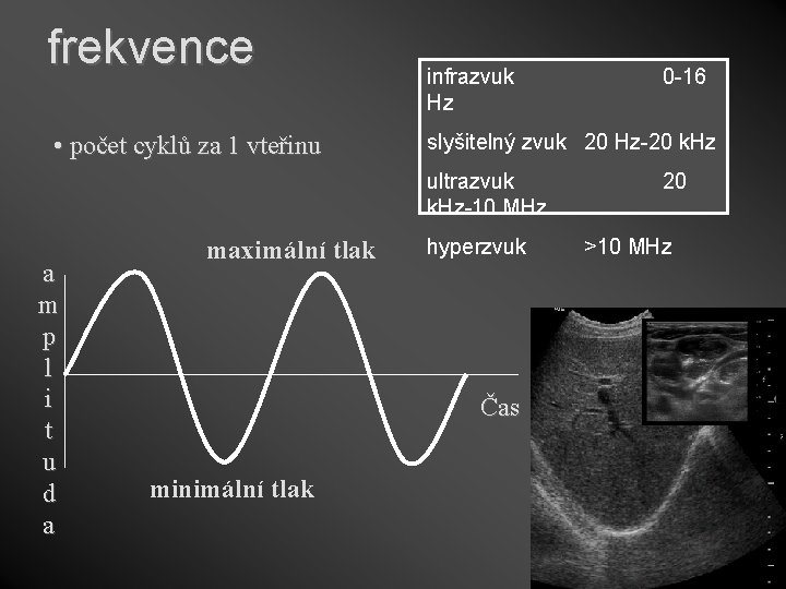 frekvence • počet cyklů za 1 vteřinu infrazvuk Hz slyšitelný zvuk 20 Hz-20 k. frekvence • počet cyklů za 1 vteřinu infrazvuk Hz slyšitelný zvuk 20 Hz-20 k.