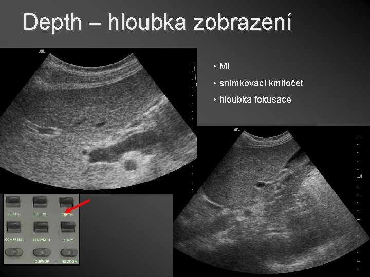 Depth – hloubka zobrazení • Doplnit • MI • snímkovací kmitočet • hloubka fokusace