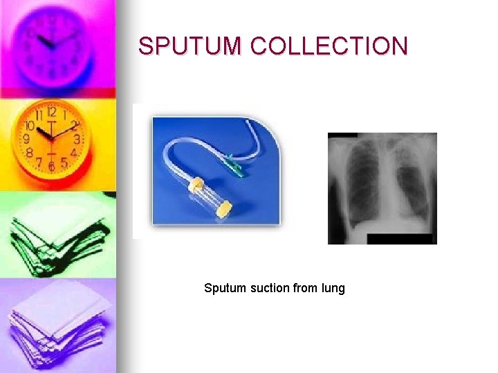 SPUTUM COLLECTION Sputum suction from lung 