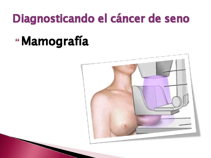 Diagnosticando el cáncer de seno Mamografía 