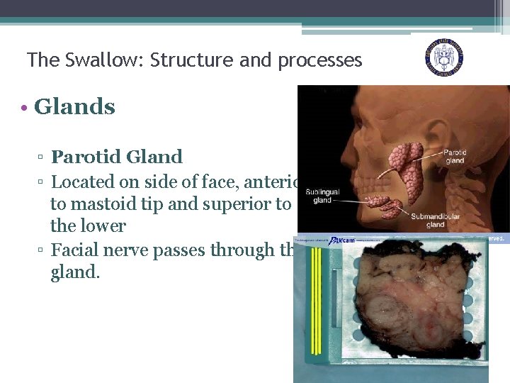 The Swallow: Structure and processes • Glands ▫ Parotid Gland ▫ Located on side