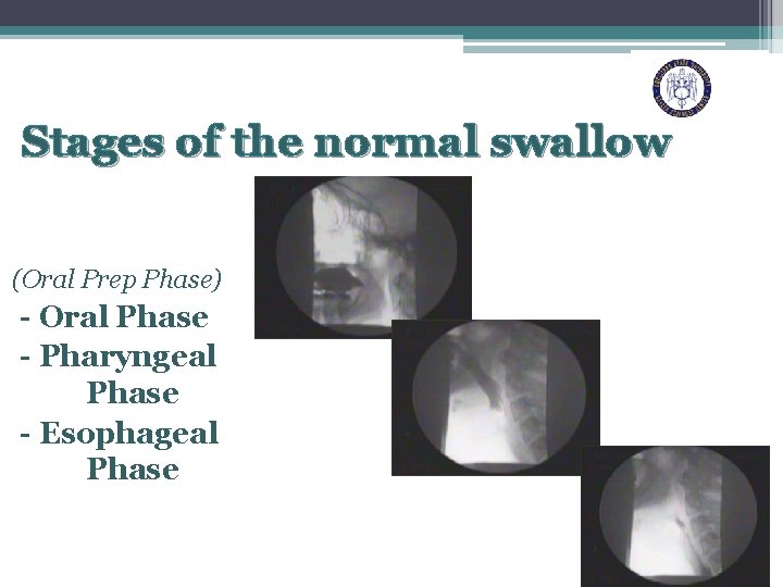 Stages of the normal swallow (Oral Prep Phase) - Oral Phase - Pharyngeal Phase