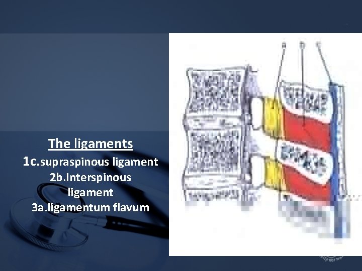 The ligaments 1 c. supraspinous ligament 2 b. Interspinous ligament 3 a. ligamentum flavum The ligaments 1 c. supraspinous ligament 2 b. Interspinous ligament 3 a. ligamentum flavum