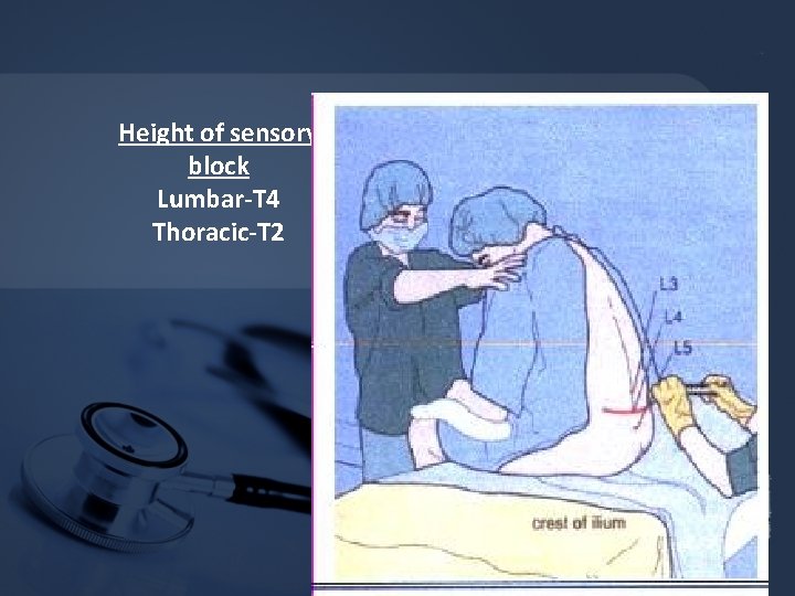 Height of sensory block Lumbar-T 4 Thoracic-T 2 Height of sensory block Lumbar-T 4 Thoracic-T 2