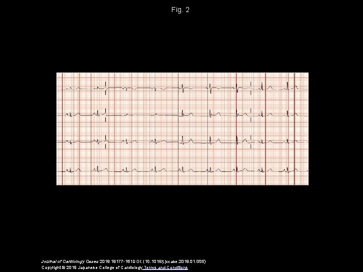 Fig. 2 Journal of Cardiology Cases 2019 19177 -181 DOI: (10. 1016/j. jccase. 2019.