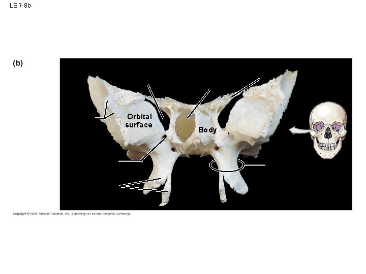 LE 7 -8 b Orbital surface Body LE 7 -8 b Orbital surface Body