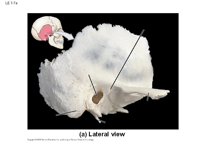 LE 7 -7 a Lateral view LE 7 -7 a Lateral view