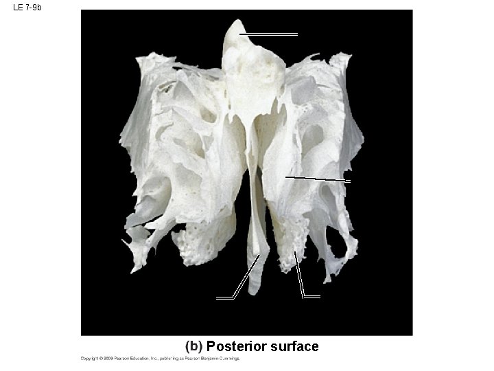 LE 7 -9 b Posterior surface LE 7 -9 b Posterior surface