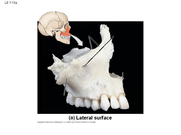 LE 7 -10 a Lateral surface LE 7 -10 a Lateral surface
