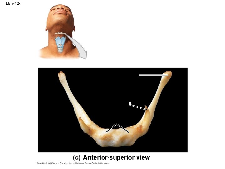 LE 7 -12 c Anterior-superior view LE 7 -12 c Anterior-superior view