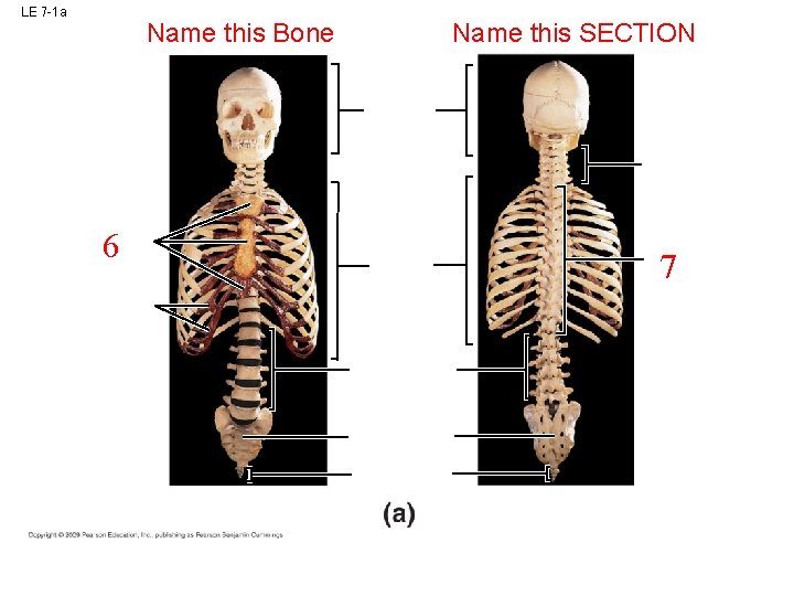 LE 7 -1 a Name this Bone 6 Name this SECTION 7 LE 7 -1 a Name this Bone 6 Name this SECTION 7