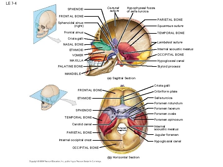 LE 7 -4 SPHENOID Coronal suture Hypophyseal fossa of sella turcica FRONTAL BONE PARIETAL LE 7 -4 SPHENOID Coronal suture Hypophyseal fossa of sella turcica FRONTAL BONE PARIETAL
