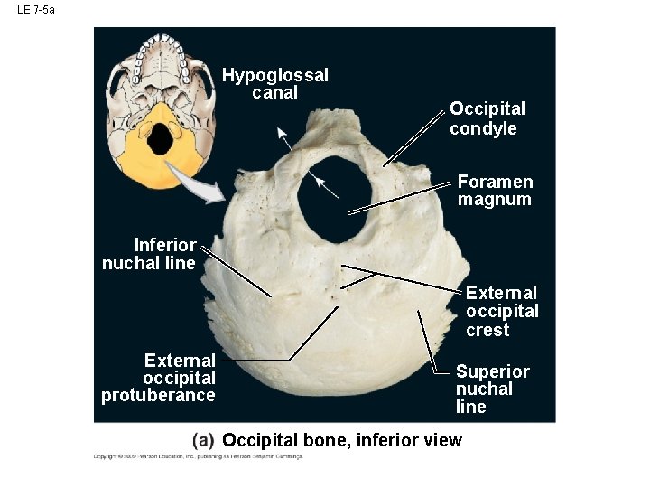 LE 7 -5 a Hypoglossal canal Occipital condyle Foramen magnum Inferior nuchal line External LE 7 -5 a Hypoglossal canal Occipital condyle Foramen magnum Inferior nuchal line External