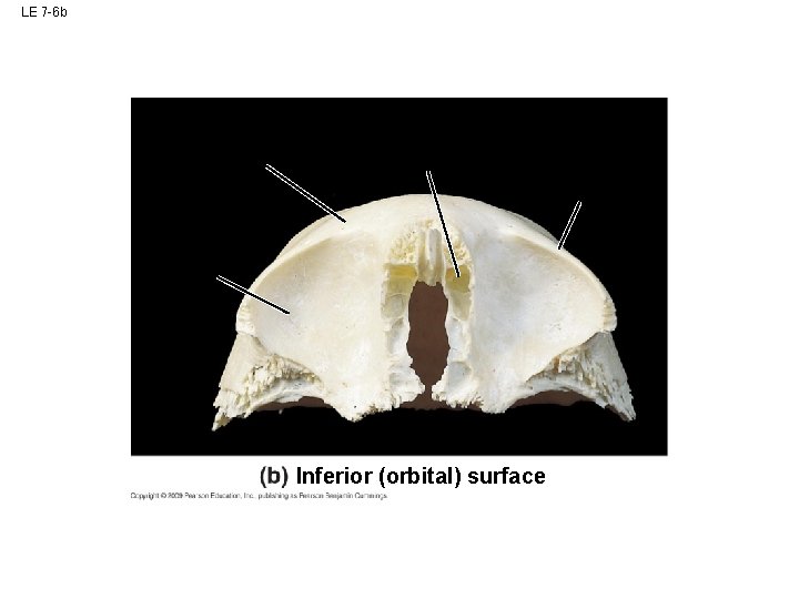 LE 7 -6 b Inferior (orbital) surface LE 7 -6 b Inferior (orbital) surface