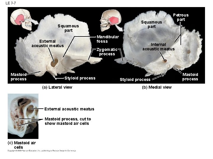 LE 7 -7 Squamous part Mandibular fossa External acoustic meatus Mastoid process Zygomatic process LE 7 -7 Squamous part Mandibular fossa External acoustic meatus Mastoid process Zygomatic process