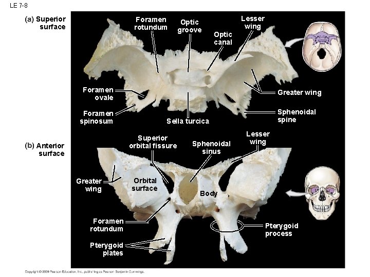 LE 7 -8 Superior surface Foramen rotundum Optic groove Lesser wing Optic canal Foramen LE 7 -8 Superior surface Foramen rotundum Optic groove Lesser wing Optic canal Foramen