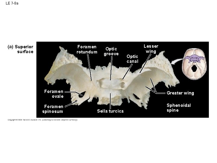 LE 7 -8 a Superior surface Foramen rotundum Optic groove Foramen ovale Foramen spinosum LE 7 -8 a Superior surface Foramen rotundum Optic groove Foramen ovale Foramen spinosum