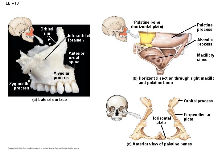 LE 7 -10 Palatine bone (horizontal plate) Orbital rim Palatine process Infra-orbital foramen Alveolar LE 7 -10 Palatine bone (horizontal plate) Orbital rim Palatine process Infra-orbital foramen Alveolar