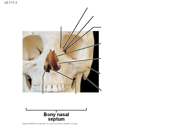 LE 7 -11 -2 Bony nasal septum LE 7 -11 -2 Bony nasal septum