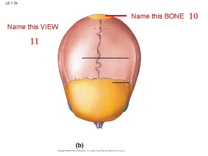 LE 7 -3 b Name this BONE Name this VIEW 11 10 LE 7 -3 b Name this BONE Name this VIEW 11 10