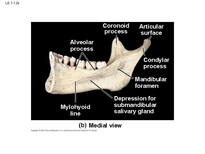 LE 7 -12 b Coronoid process Articular surface Alveolar process Condylar process Mandibular foramen LE 7 -12 b Coronoid process Articular surface Alveolar process Condylar process Mandibular foramen