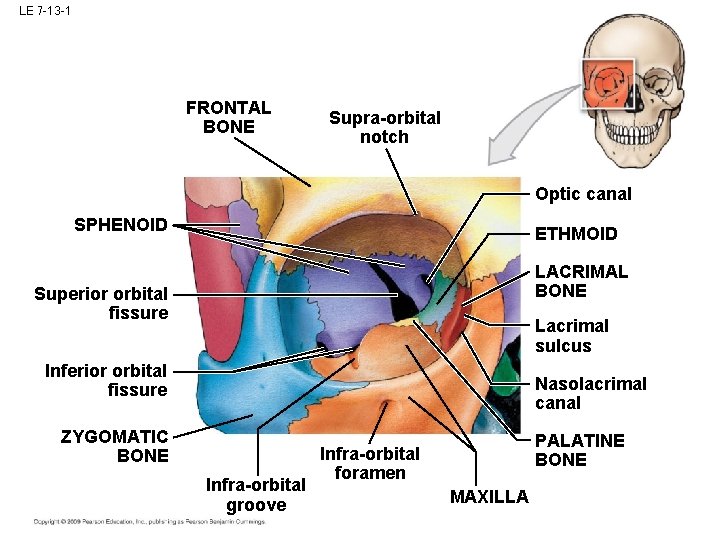 LE 7 -13 -1 FRONTAL BONE Supra-orbital notch Optic canal SPHENOID ETHMOID LACRIMAL BONE LE 7 -13 -1 FRONTAL BONE Supra-orbital notch Optic canal SPHENOID ETHMOID LACRIMAL BONE