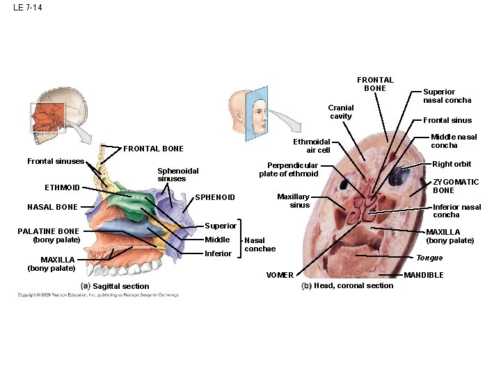 LE 7 -14 FRONTAL BONE Cranial cavity Ethmoidal air cell FRONTAL BONE Frontal sinuses LE 7 -14 FRONTAL BONE Cranial cavity Ethmoidal air cell FRONTAL BONE Frontal sinuses