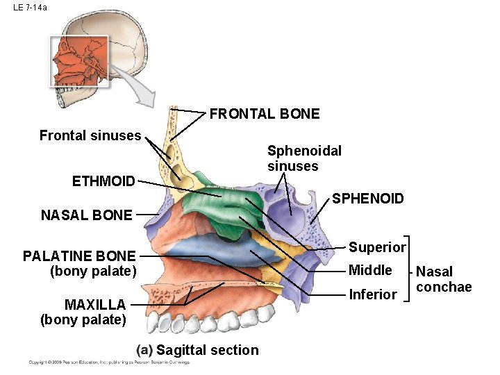 LE 7 -14 a FRONTAL BONE Frontal sinuses Sphenoidal sinuses ETHMOID SPHENOID NASAL BONE LE 7 -14 a FRONTAL BONE Frontal sinuses Sphenoidal sinuses ETHMOID SPHENOID NASAL BONE