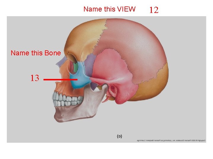 Name this VIEW Name this Bone 13 12 Name this VIEW Name this Bone 13 12