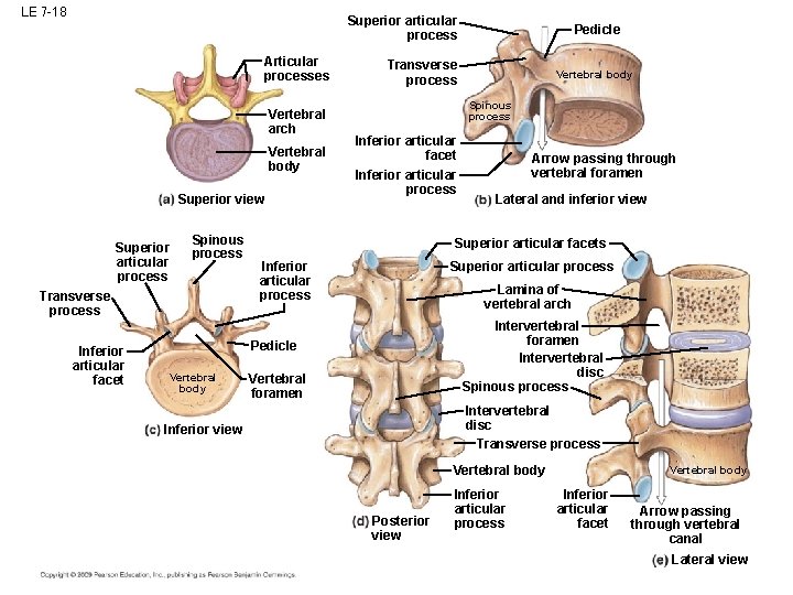 LE 7 -18 Superior articular process Articular processes Vertebral arch Vertebral body Superior view LE 7 -18 Superior articular process Articular processes Vertebral arch Vertebral body Superior view