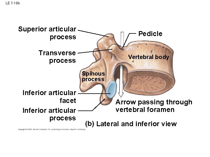 LE 7 -18 b Superior articular process Pedicle Transverse process Vertebral body Spinous process LE 7 -18 b Superior articular process Pedicle Transverse process Vertebral body Spinous process