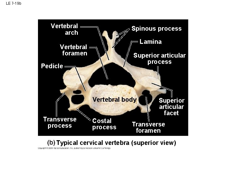 LE 7 -19 b Vertebral arch Spinous process Lamina Vertebral foramen Superior articular process LE 7 -19 b Vertebral arch Spinous process Lamina Vertebral foramen Superior articular process