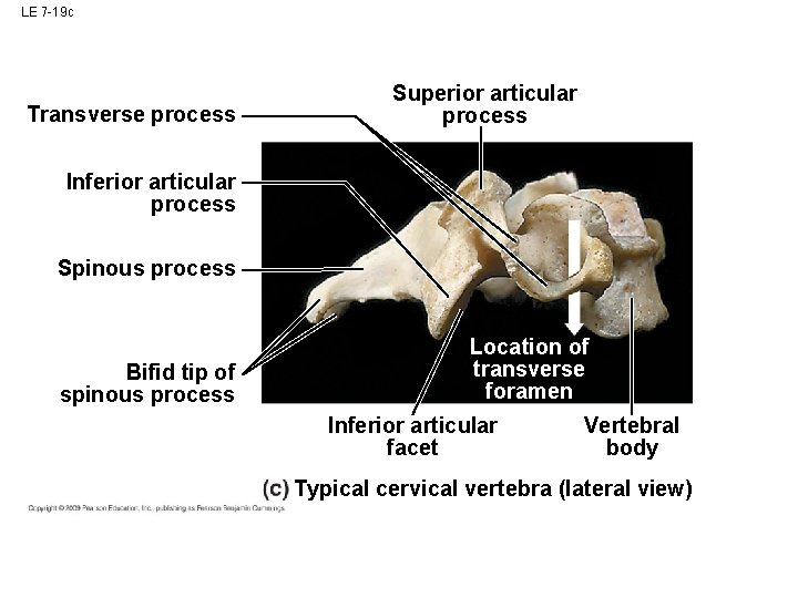 LE 7 -19 c Transverse process Superior articular process Inferior articular process Spinous process LE 7 -19 c Transverse process Superior articular process Inferior articular process Spinous process