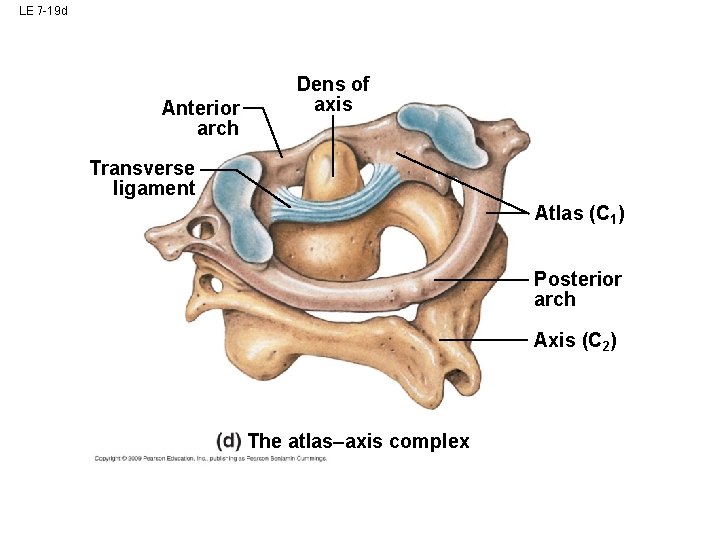 LE 7 -19 d Anterior arch Dens of axis Transverse ligament Atlas (C 1) LE 7 -19 d Anterior arch Dens of axis Transverse ligament Atlas (C 1)