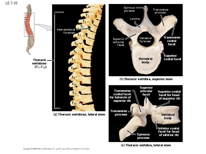 LE 7 -20 Spinous process T 1 Lamina T 2 Intervertebral foramen Transverse process LE 7 -20 Spinous process T 1 Lamina T 2 Intervertebral foramen Transverse process