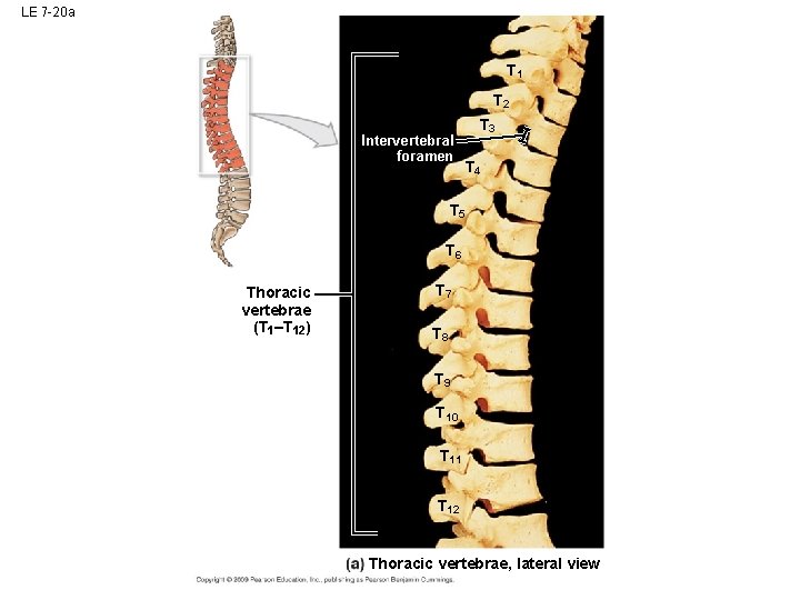 LE 7 -20 a T 1 T 2 Intervertebral foramen T 3 T 4 LE 7 -20 a T 1 T 2 Intervertebral foramen T 3 T 4