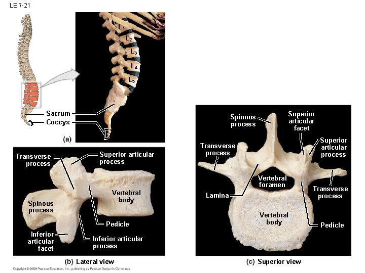 LE 7 -21 L 2 L 3 L 4 L 5 Sacrum Coccyx Transverse LE 7 -21 L 2 L 3 L 4 L 5 Sacrum Coccyx Transverse