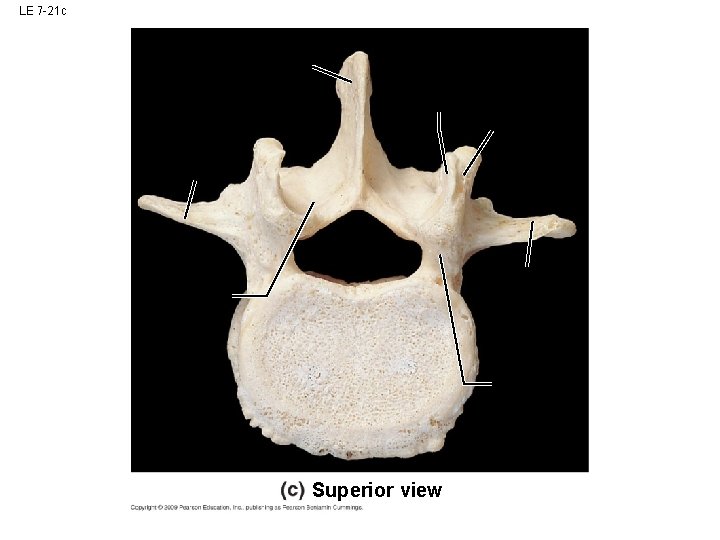 LE 7 -21 c Superior view LE 7 -21 c Superior view