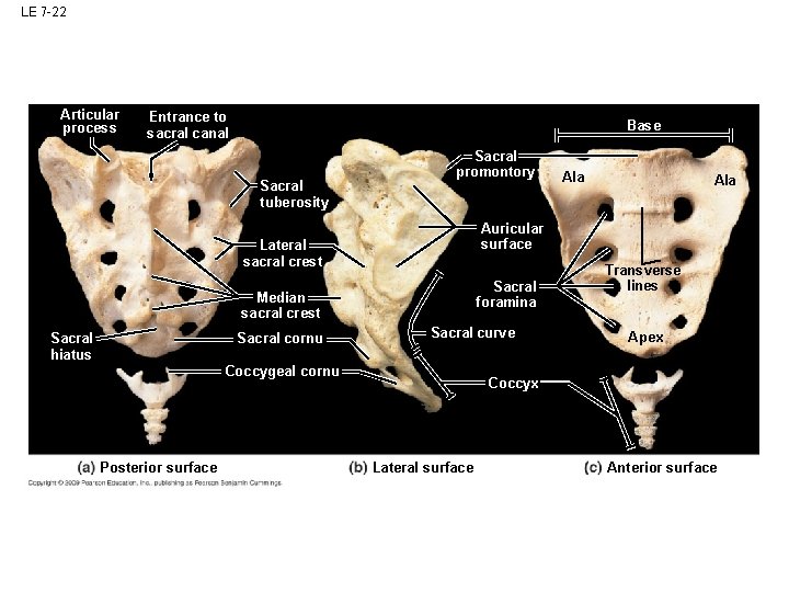 LE 7 -22 Articular process Entrance to sacral canal Base Sacral tuberosity Sacral promontory LE 7 -22 Articular process Entrance to sacral canal Base Sacral tuberosity Sacral promontory