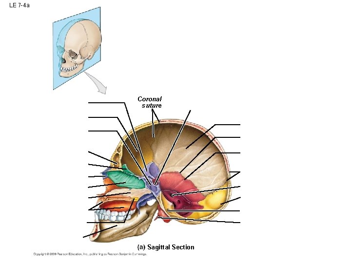 LE 7 -4 a Coronal suture Sagittal Section LE 7 -4 a Coronal suture Sagittal Section