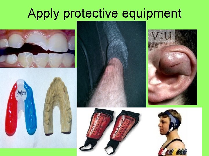 Apply protective equipment 