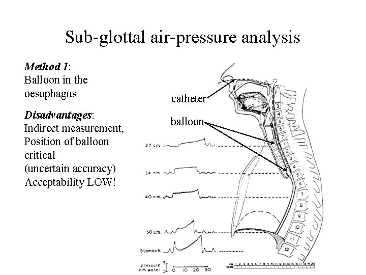 Sub-glottal air-pressure analysis Method 1: Balloon in the oesophagus Disadvantages: Indirect measurement, Position of Sub-glottal air-pressure analysis Method 1: Balloon in the oesophagus Disadvantages: Indirect measurement, Position of