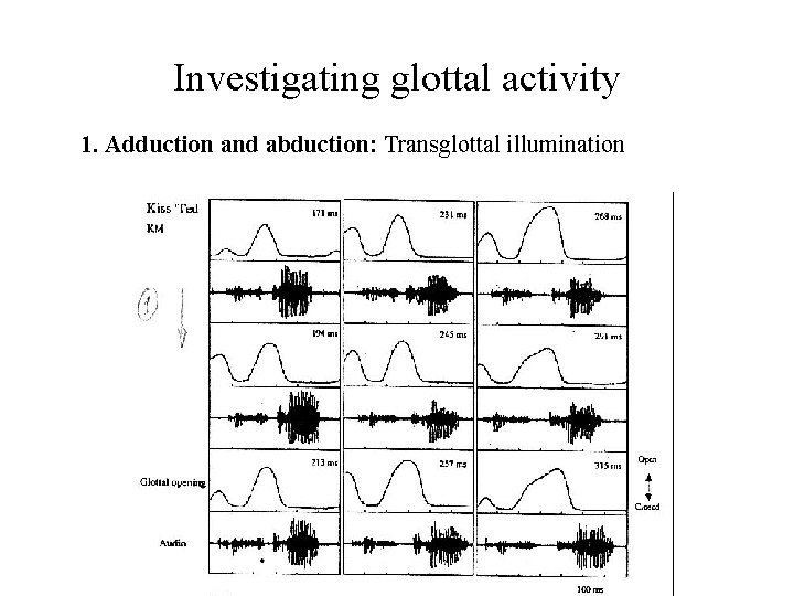 Investigating glottal activity 1. Adduction and abduction: Transglottal illumination Investigating glottal activity 1. Adduction and abduction: Transglottal illumination