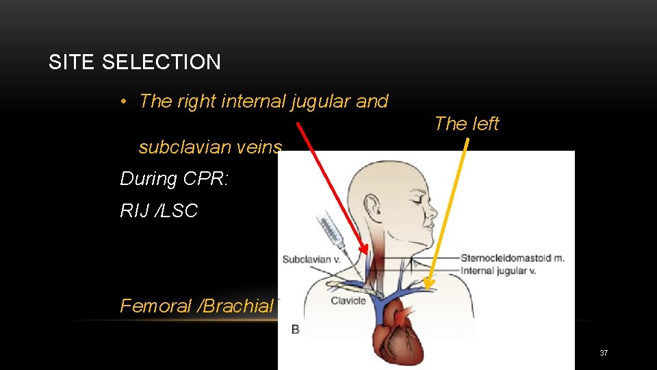 SITE SELECTION • The right internal jugular and The left subclavian veins During CPR:
