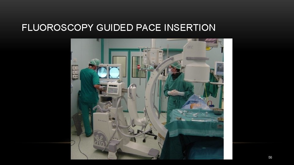 FLUOROSCOPY GUIDED PACE INSERTION 56 