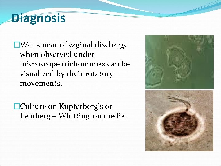 Diagnosis �Wet smear of vaginal discharge when observed under microscope trichomonas can be visualized